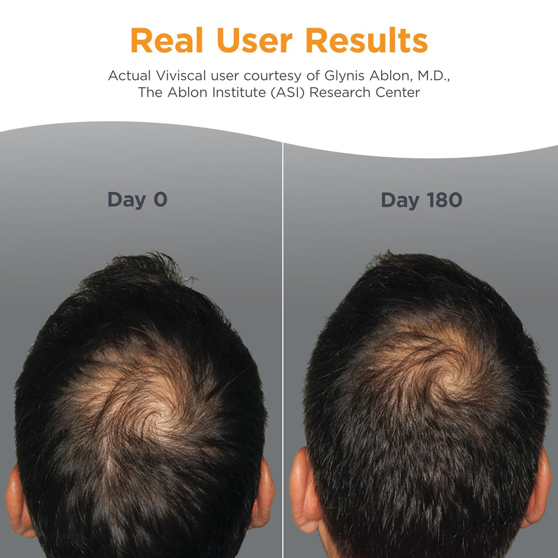 Viviscal Men’s Hair Growth Supplements 180 Tablets (Pack of 2) 180 Day Supply